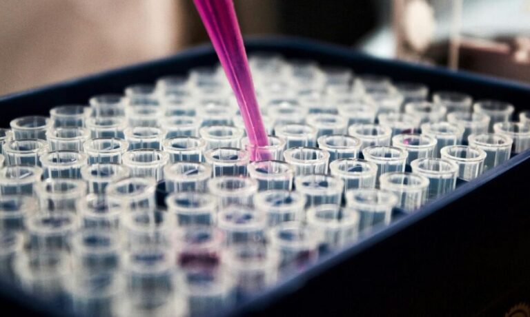 Teste de sangue pode revolucionar diagnóstico da doença de Alzheimer. Foto: Louis Reed/ Unsplash