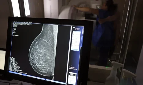 Brasília (DF), 01/10/2024 - Teste de mamografia realizado na Campanha Outubro Rosa: Sesc-DF, que oferece exames e consultas gratuitas às mulheres.  Foto: José Cruz/Agência Brasil