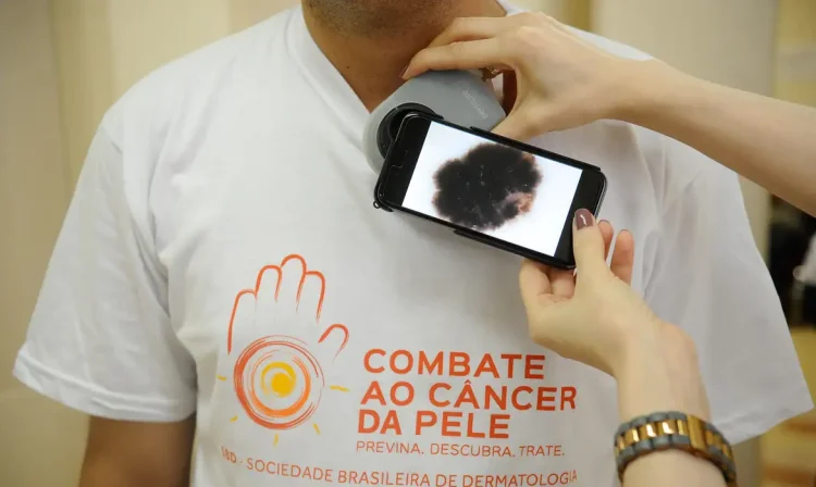 Dia Nacional de Combate ao Câncer de Pele