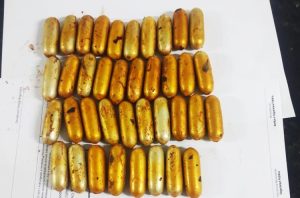 Droga doi retirada através de cirurgia