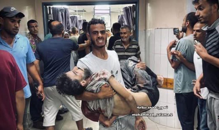 Gaza, 03/07/2025 -  Abdullah Hammad é carregado no hospital Nasser após ter sido baleado por forças israelenses, quando tentava coletar um saco de farinha no sul de Gaza. Foto: Médicos Sem Fronteiras/Divulgação