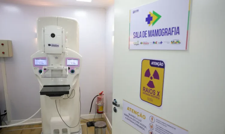 Brasília (DF) 23/10/2025 - Equipamento de mamografia da carreta de saúde da mulher do programa Agora Tem Especialistas no estacionamento do Hospital Regional de Ceilândia, cidade satélite de Brasília Foto: Fabio Rodrigues-Pozzebom/ Agência Brasil