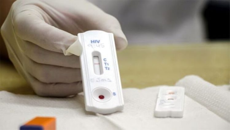 teste-HIV NOVO