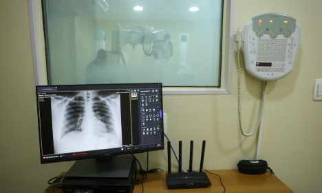 Rio de Janeiro (RJ), 17/01/2025 – Aparelhos de raio-X no Hospital Federal de Bonsucesso, na zona norte do Rio de Janeiro. Foto: Tomaz Silva/Agência Brasil